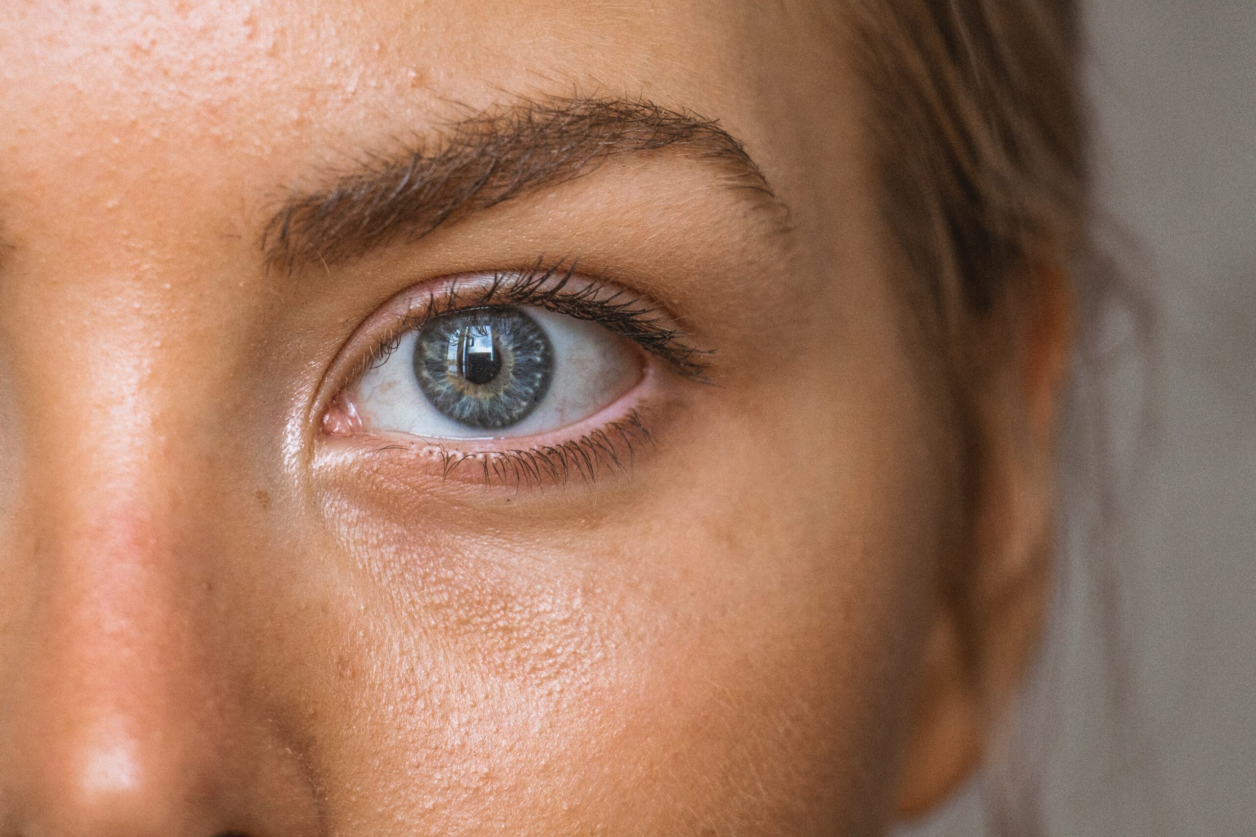 woman's face and eye showing a face of lyme disease