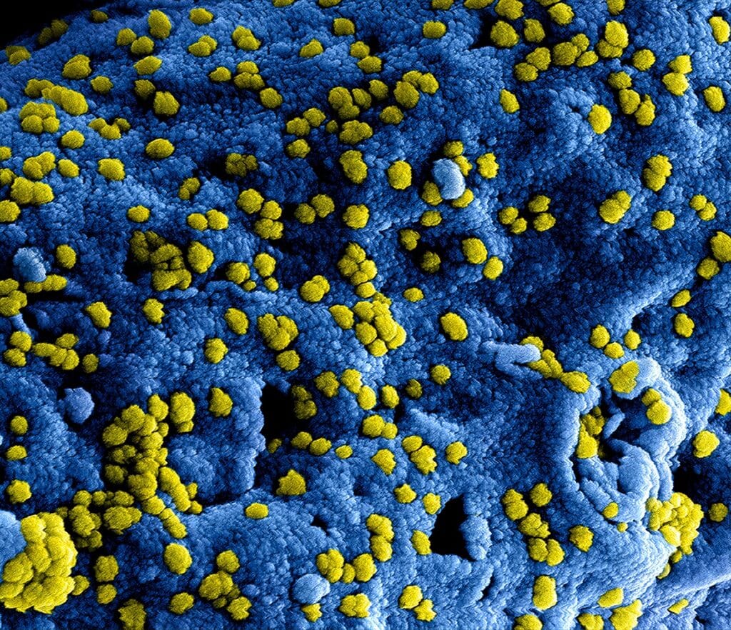 image of microscopic virus infection