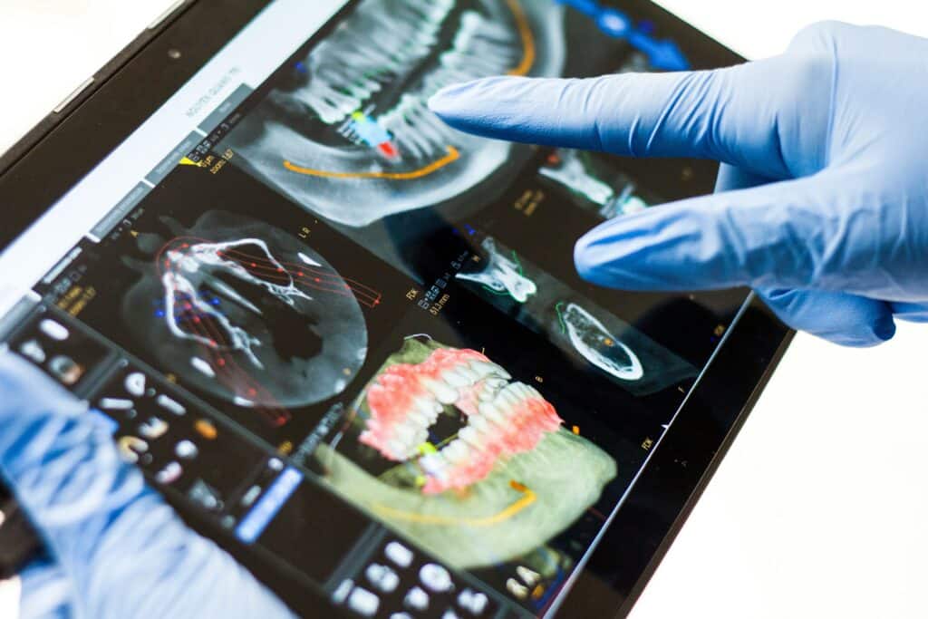 biological dentist sharing the damage lyme disease can do to teeth